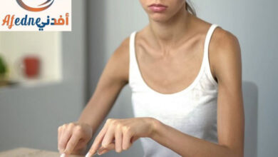 اضطرابات الأكل