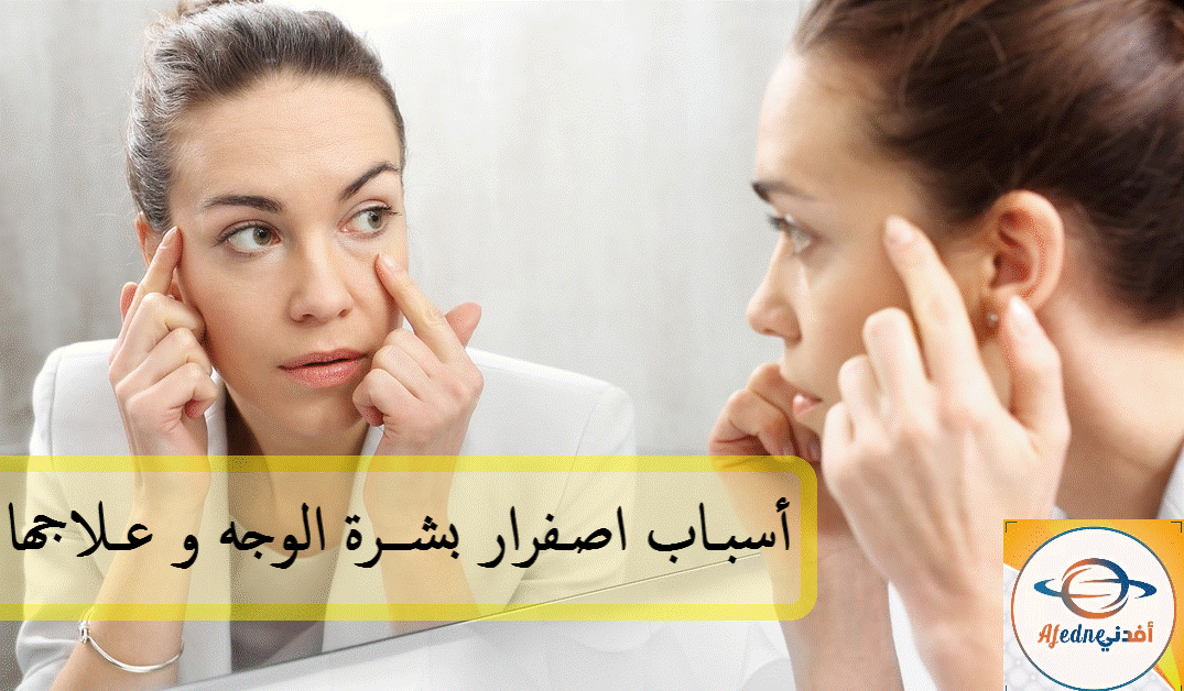 أسباب أصفرار بشرة الوجة؟وطرق علاجه